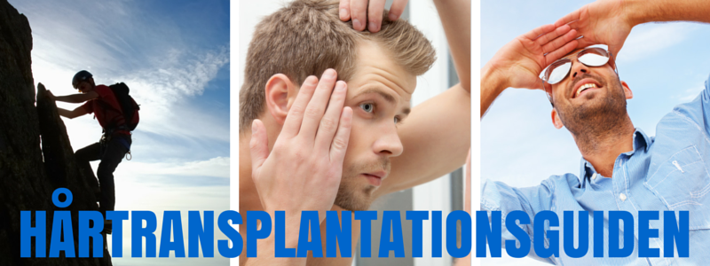 Hårtransplantationsguiden